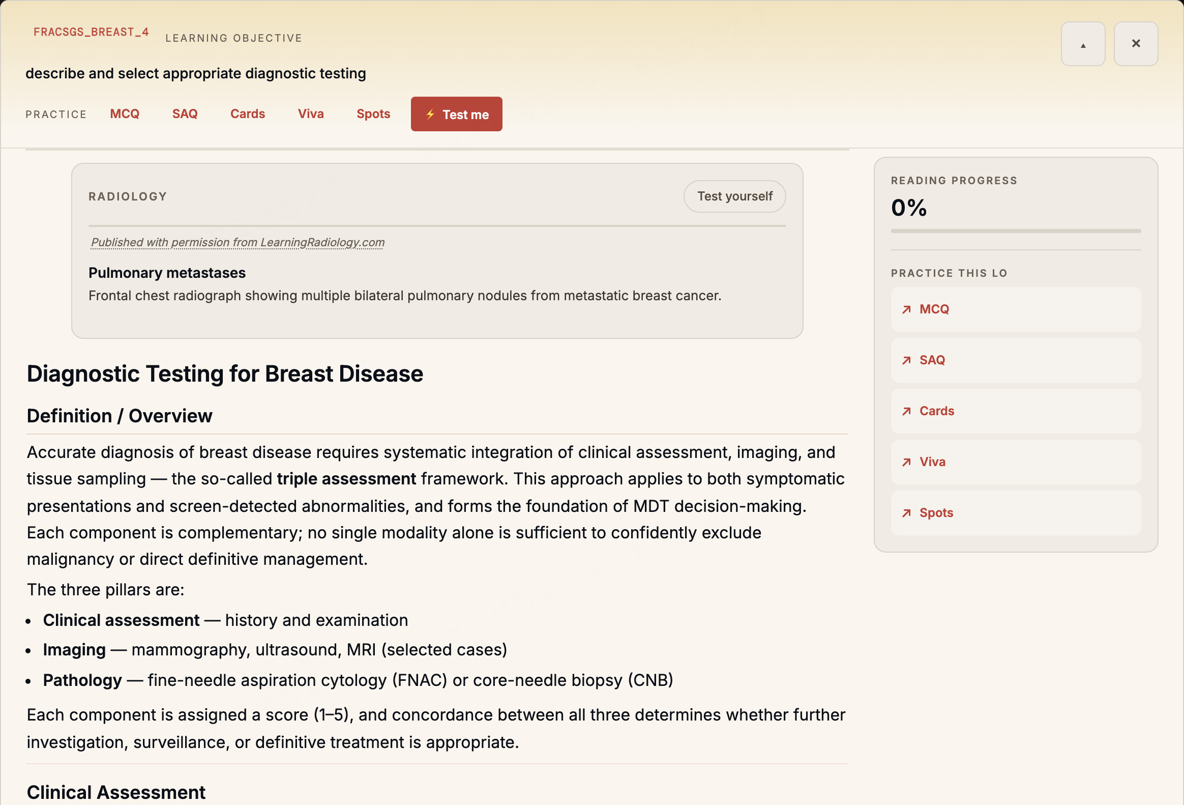 FRACS General Surgery study note on breast diagnostics with an embedded radiology plate and practice rail