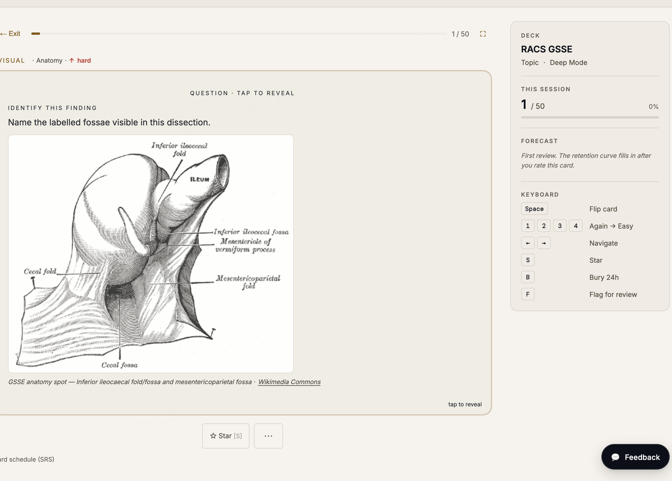 RACS GSSE anatomy spot: a labelled cadaveric dissection asking the candidate to identify the structure