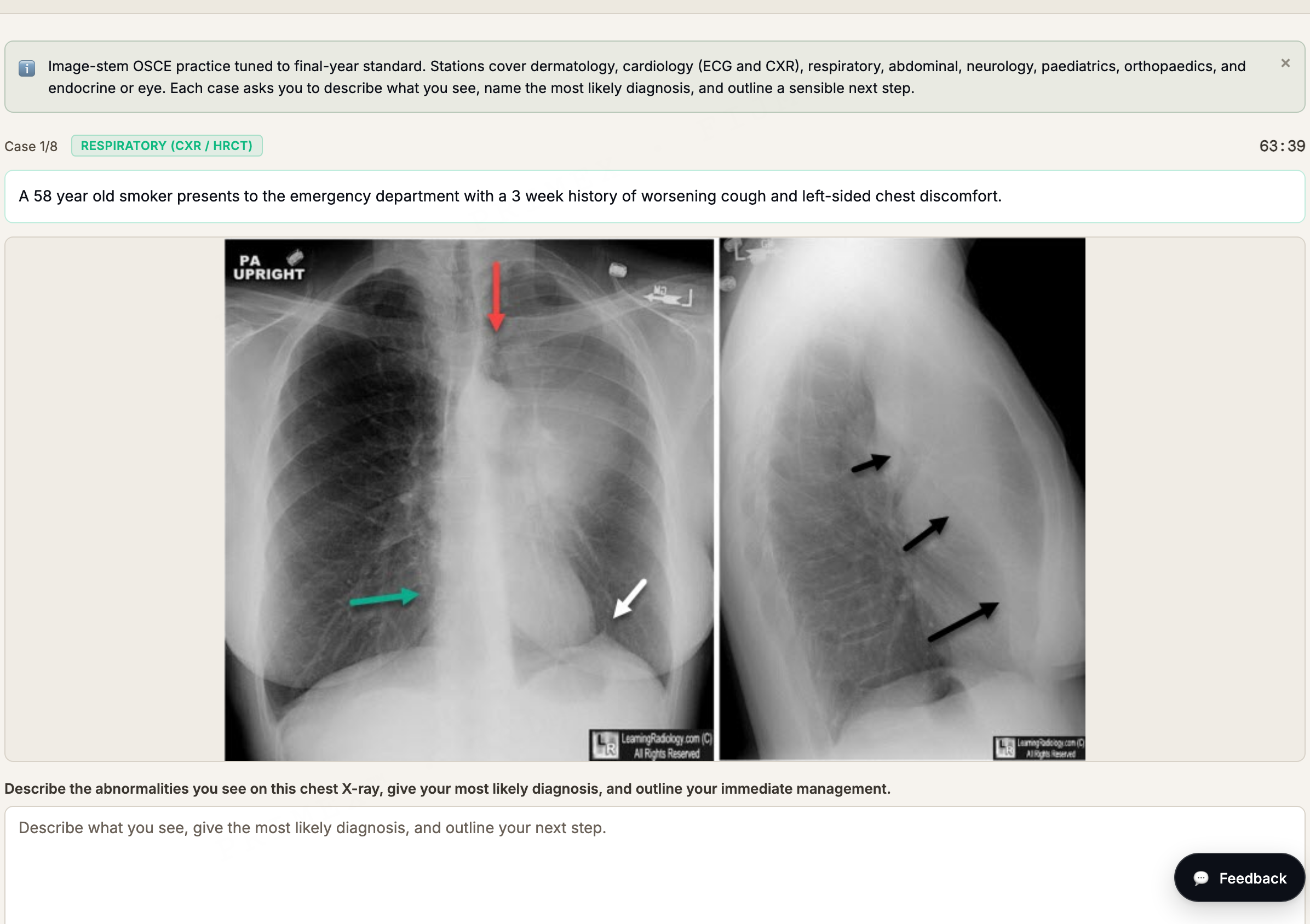Image-stem OSCE practice in session: a respiratory case opening with annotated chest radiographs, a clinical stem and a structured answer box