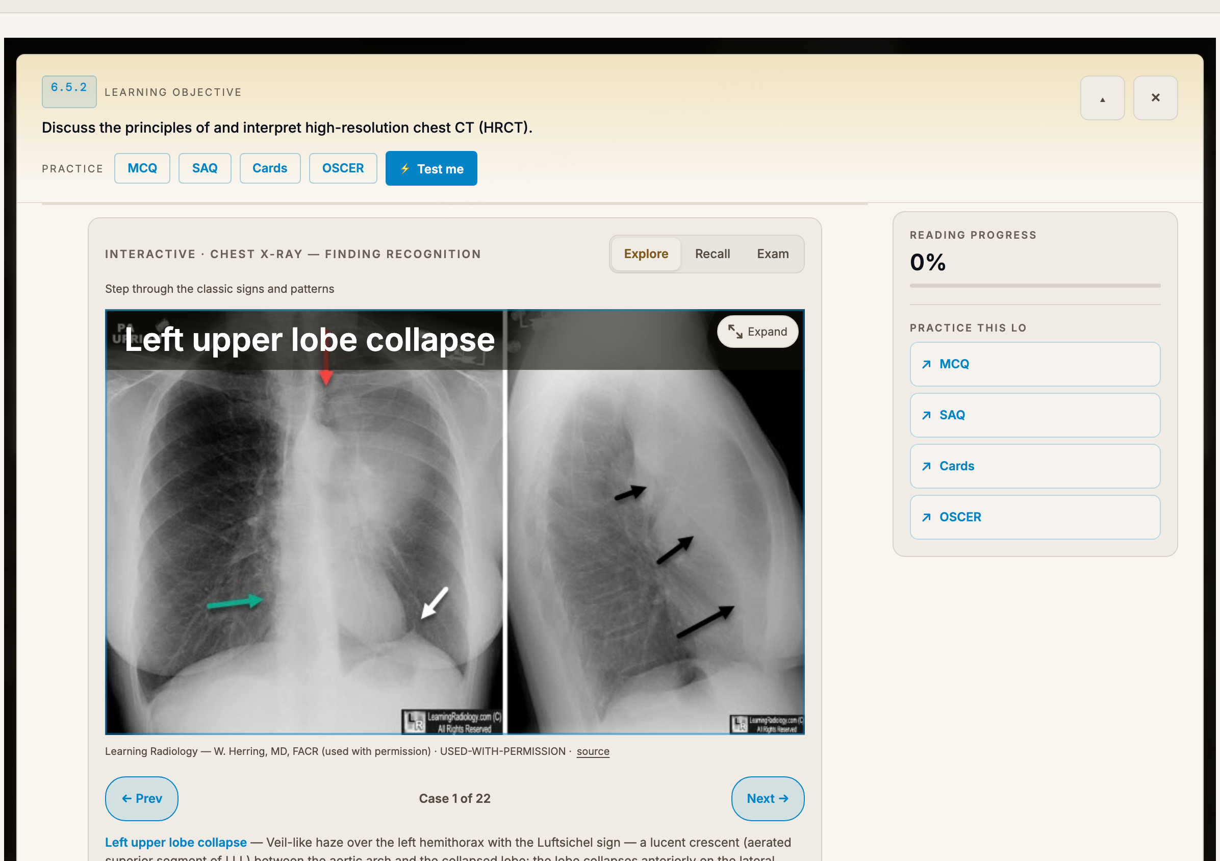 RANZCR Part 2 study note: an HRCT learning objective with an embedded interactive chest imaging finding-recognition trainer