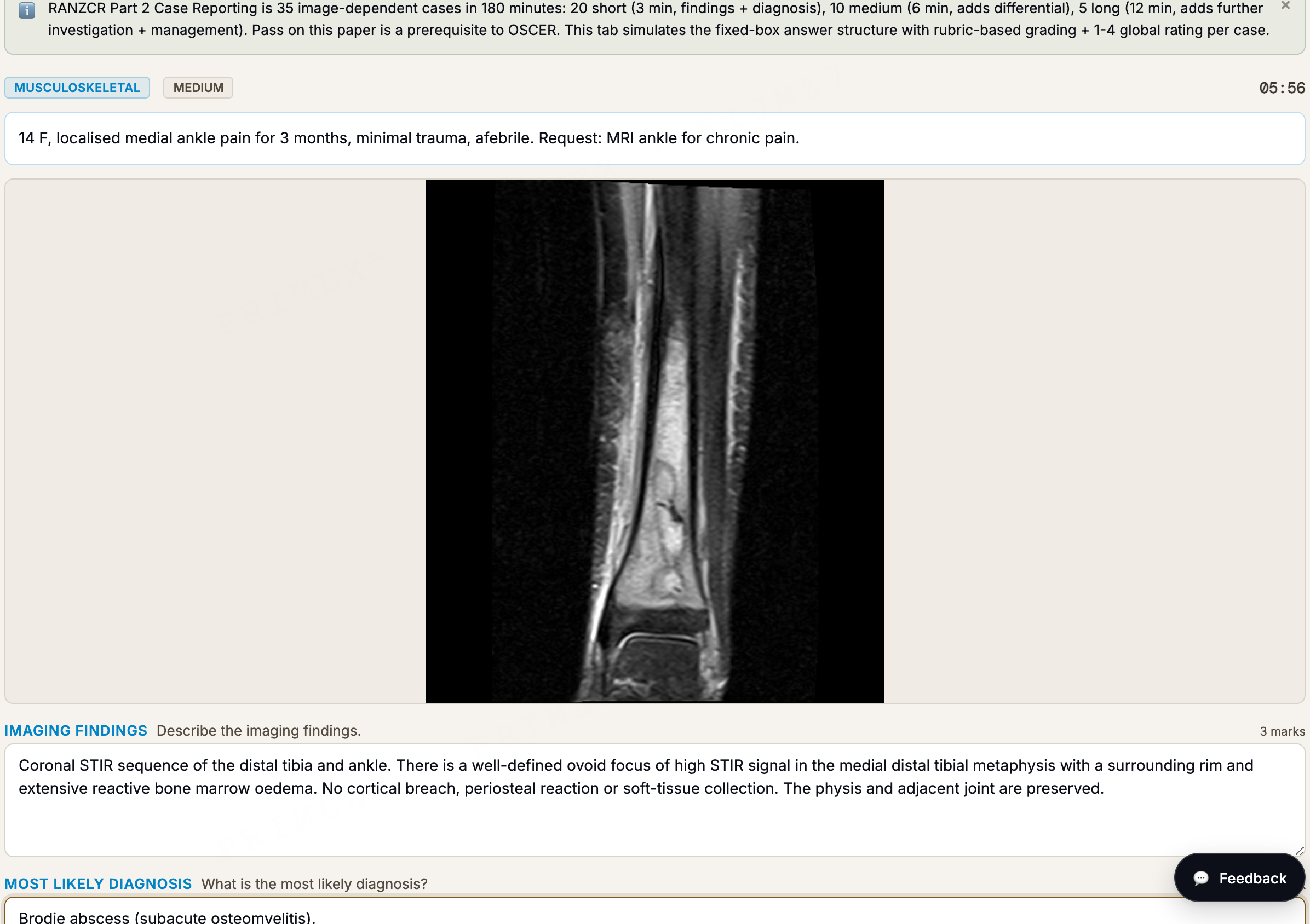 RANZCR Part 2 case reporting: an image-dependent musculoskeletal MRI case with a structured, mark-allocated reporting form for imaging findings and most likely diagnosis