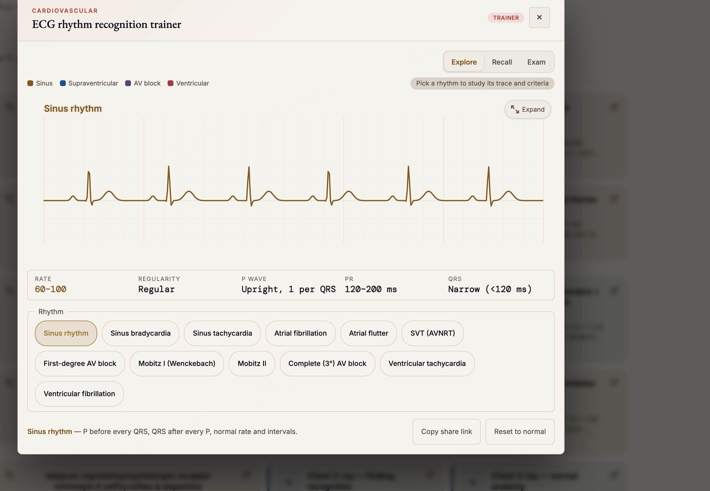 ACEM Primary interactive diagram: an ECG rhythm recognition trainer with Explore, Recall and Exam modes