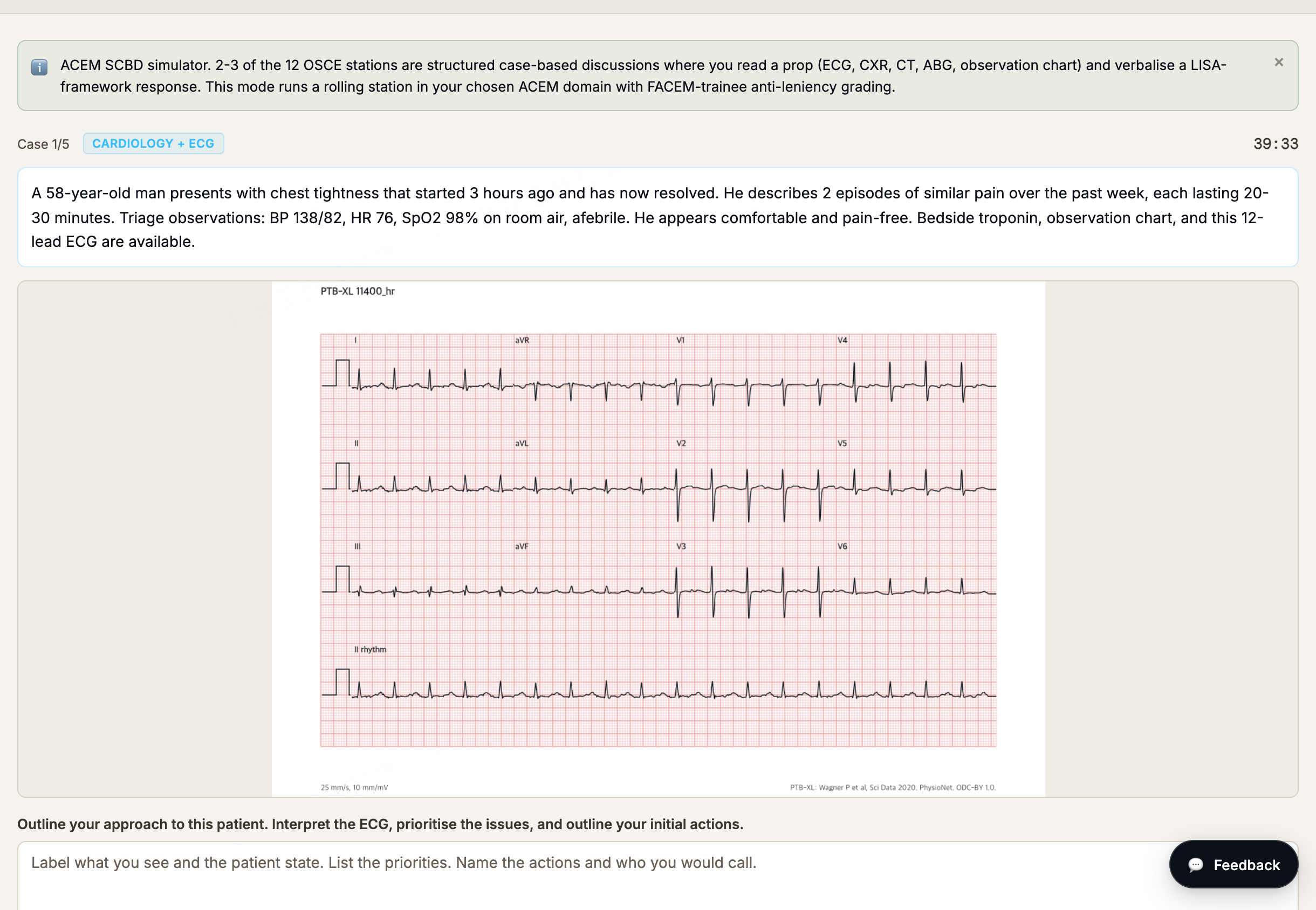 ACEM Fellowship SCBD simulator: an image-anchored cardiology case showing a 12-lead ECG prop with a structured case-based discussion prompt
