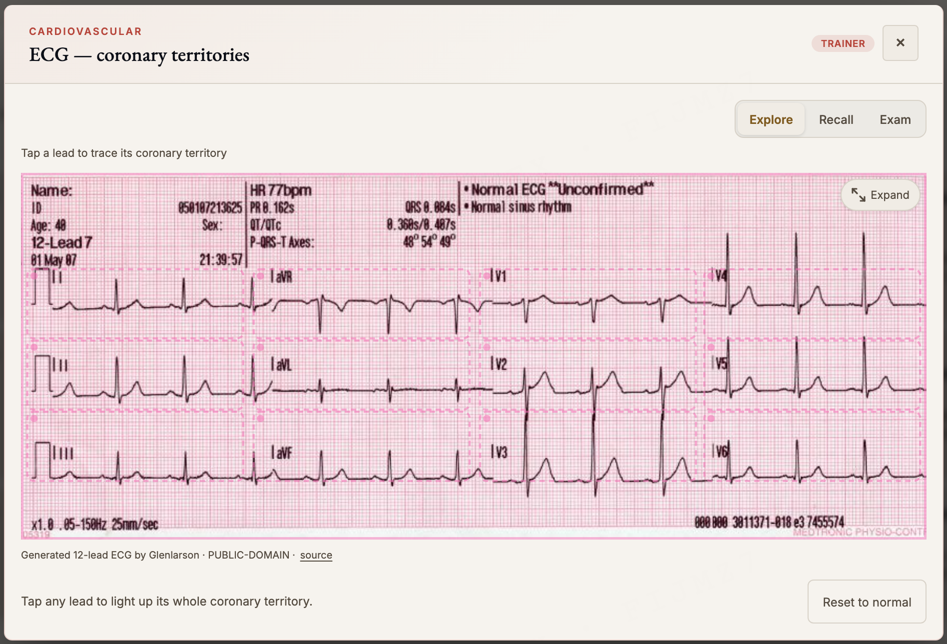 RACP BPT interactive diagram: a live 12-lead ECG coronary-territories trainer