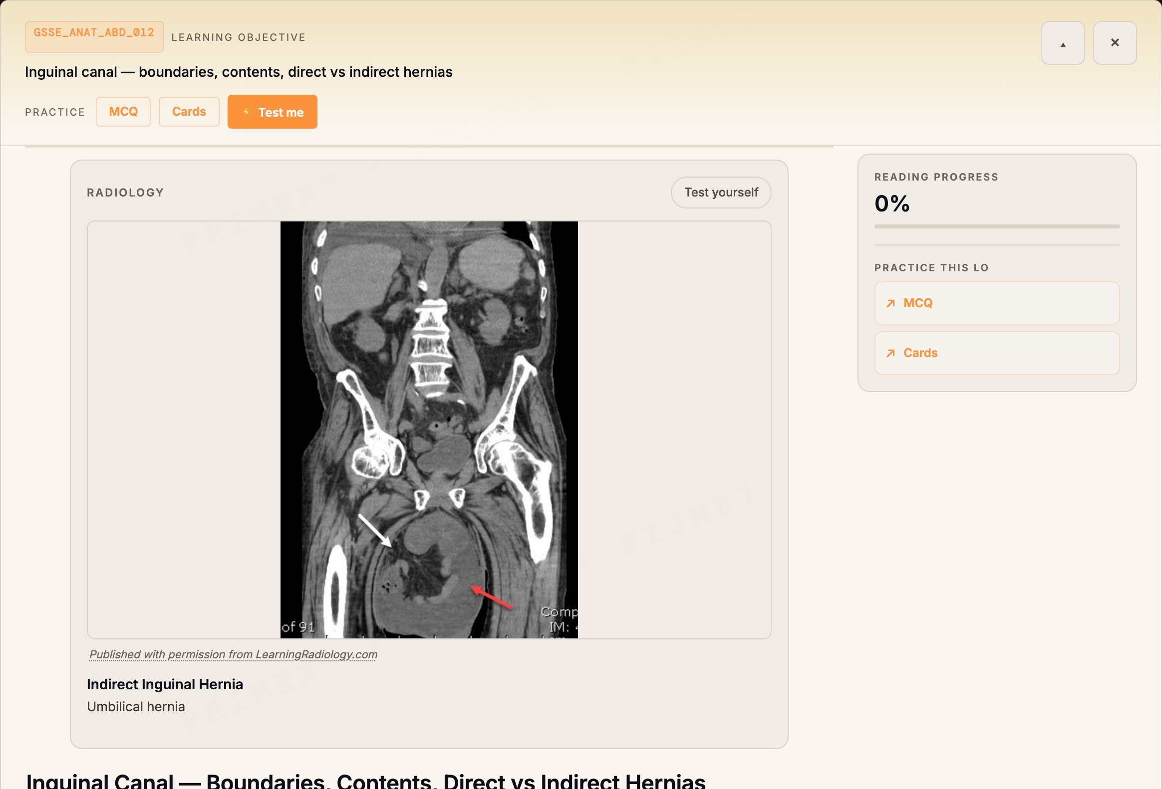 RACS GSSE study note on inguinal canal anatomy with an embedded annotated radiology plate